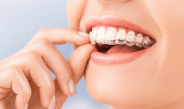 Orthodontics & Invisalign